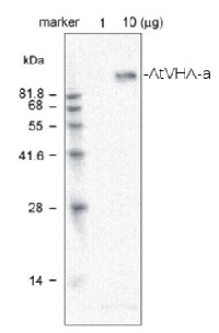 V-ATPase, a | Vacuolar H+ ATPase, subunit a in the group Antibodies Plant/Algal / Membrane Transport System / Vacuolar membrane at Agrisera AB (Antibodies for research) (AS09 466)